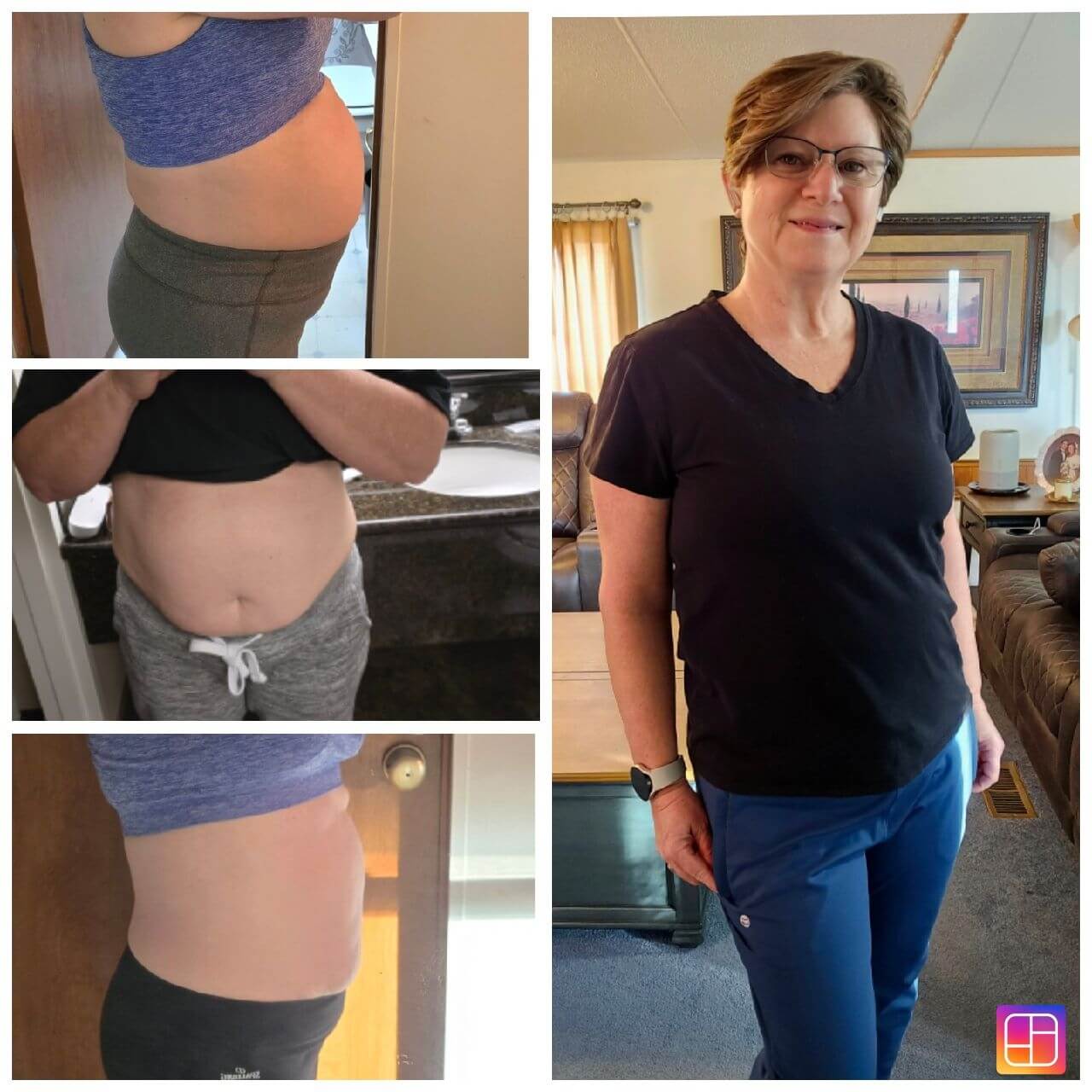 before and after Slenderiiz metabolic reset 